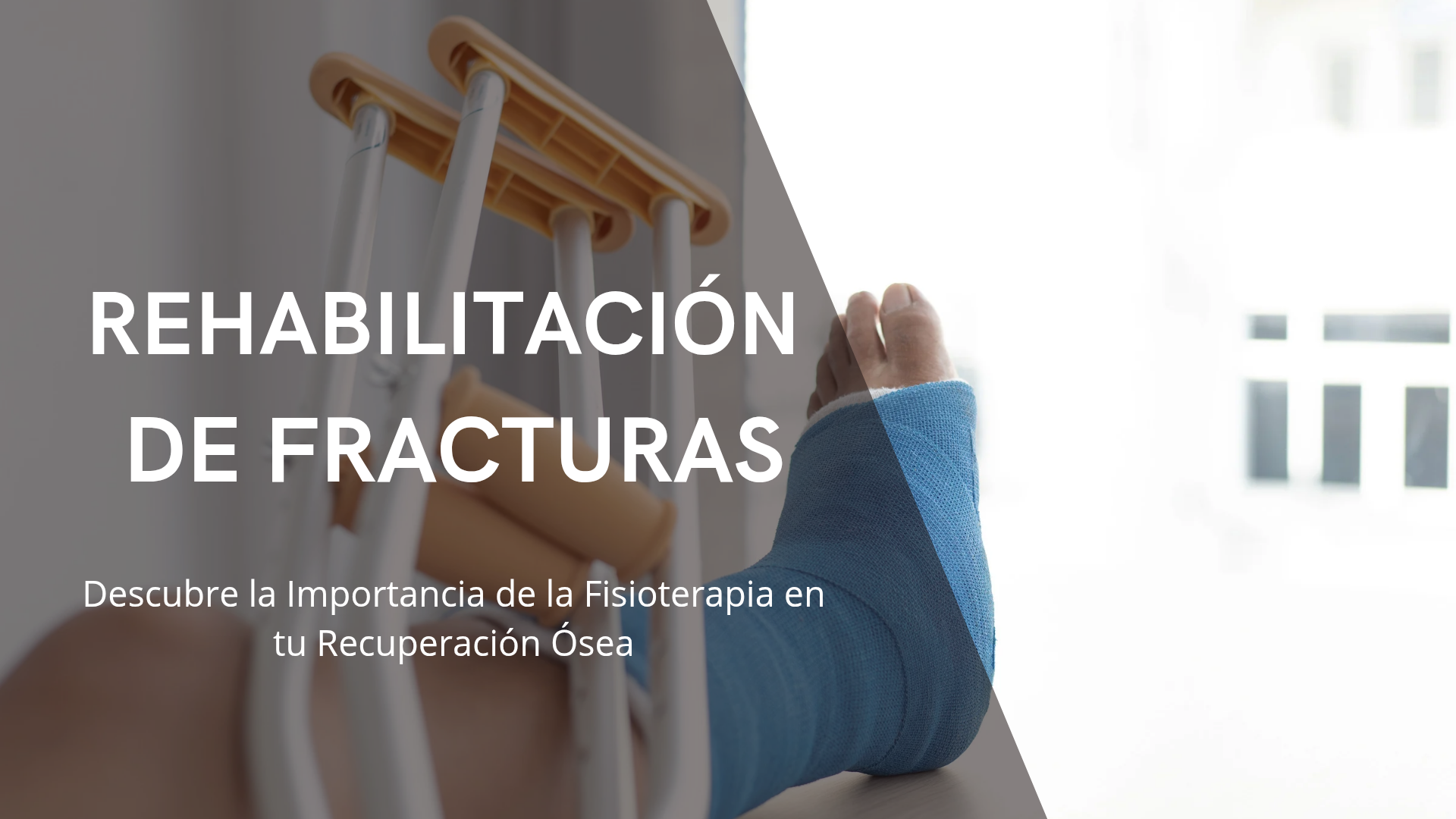 Imagen que ilustra la importancia de la fisioterapia post fractura para la recuperación de movilidad y fuerza tras una lesión ósea.