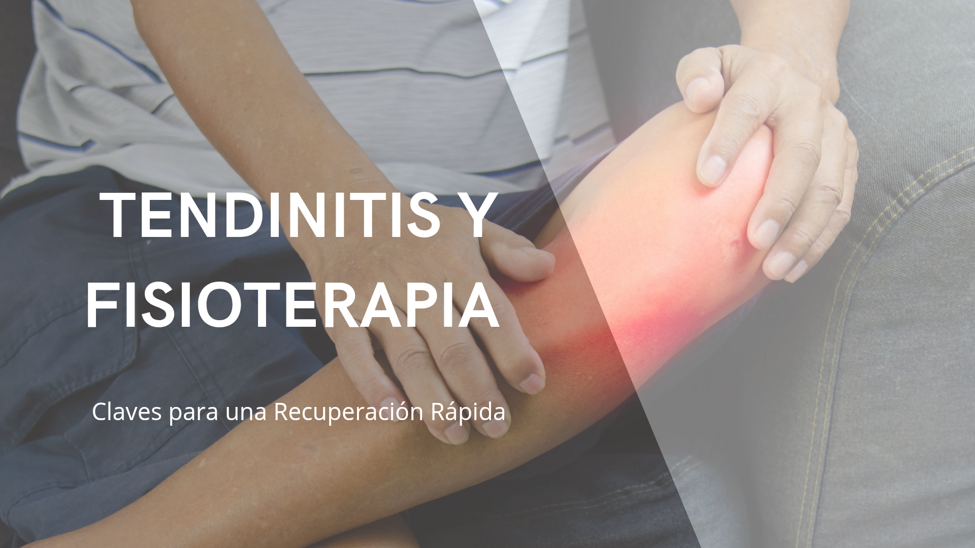Imagen de una rodilla inflamada y enrojecida que representa dolor articular o tendinitis en fase aguda.